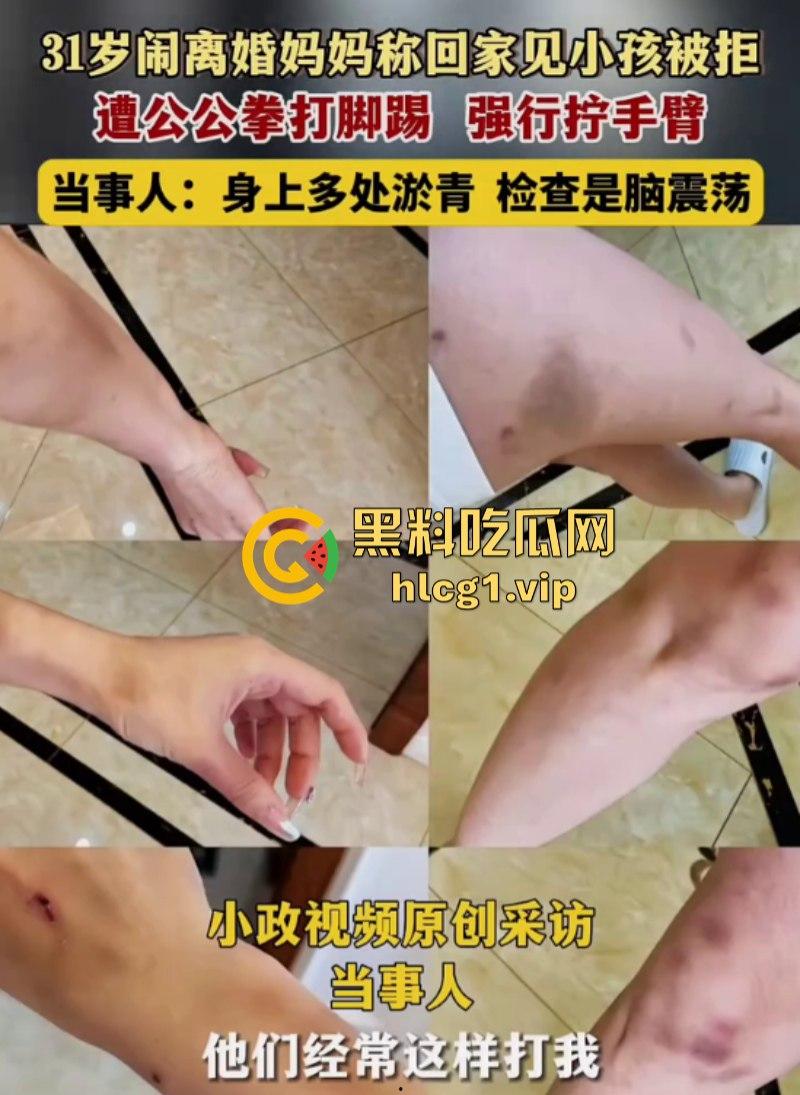 离完婚就不能见小孩？江苏泰州女子回家看小孩遭公公拳打脚踢！-1